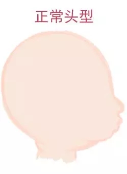 宝宝圆头好照旧扁头好？？？这些神秘许多爸妈都不知道3.webp.jpg