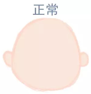 宝宝圆头好照旧扁头好？？？这些神秘许多爸妈都不知道5.webp.jpg
